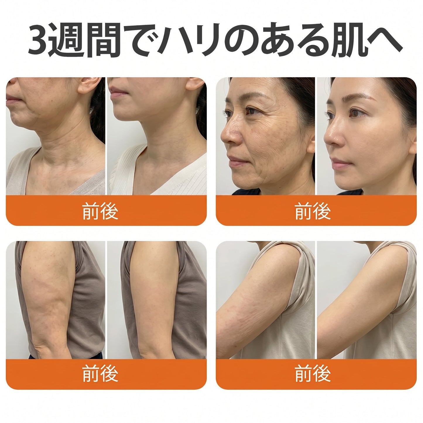 🇯🇵 日本製・日本から直送 🎐🎐  𝑽𝑳𝑺𝑽𝑳𝑺® ビーベノム コンプリヘンシブ クリーム  本日最終日｜80％OFF（肌のたるみ、乾燥による小ジワ、ハリ不足、バストラインやヒップラインの印象など、年齢とともに気になるボディスキンをトータルケア。うるおいとハリを与え、なめらかで引き締まった印象の肌へ導きます）