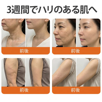 🇯🇵 日本製・日本から直送 🎐🎐  𝑽𝑳𝑺𝑽𝑳𝑺® ビーベノム コンプリヘンシブ クリーム  本日最終日｜80％OFF（肌のたるみ、乾燥による小ジワ、ハリ不足、バストラインやヒップラインの印象など、年齢とともに気になるボディスキンをトータルケア。うるおいとハリを与え、なめらかで引き締まった印象の肌へ導きます）