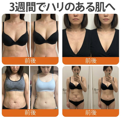 🇯🇵 日本製・日本から直送 🎐🎐  𝑽𝑳𝑺𝑽𝑳𝑺® ビーベノム コンプリヘンシブ クリーム  本日最終日｜80％OFF（肌のたるみ、乾燥による小ジワ、ハリ不足、バストラインやヒップラインの印象など、年齢とともに気になるボディスキンをトータルケア。うるおいとハリを与え、なめらかで引き締まった印象の肌へ導きます）