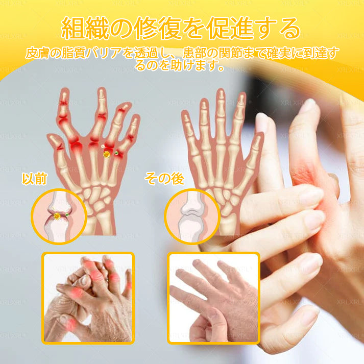 🇯🇵 日本製・日本から直送 🌱XRLXRL®🐝 ミツバチ毒配合🦴 関節・膝・腰・肩を毎日ケア✨ 軽やかな動きをサポート💚