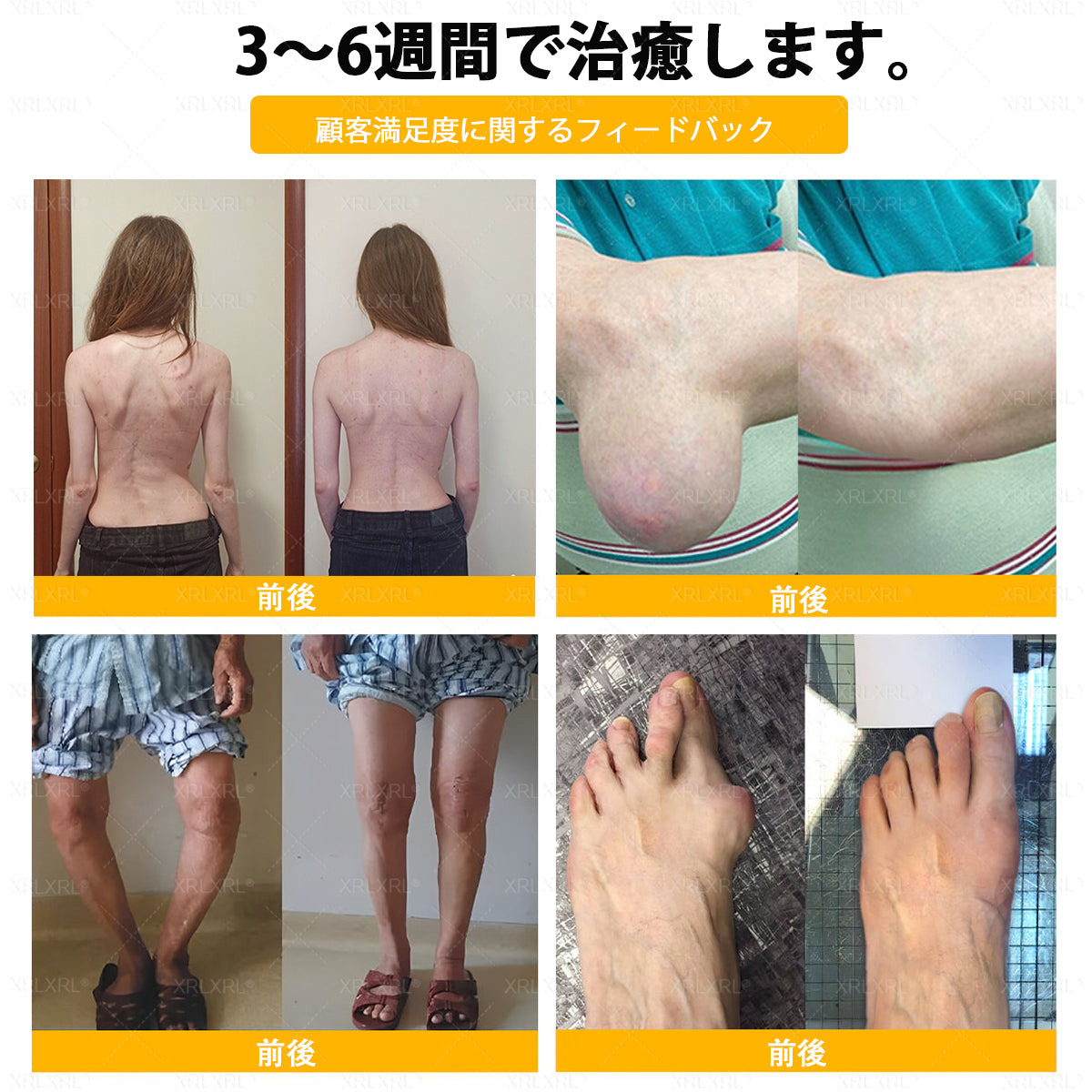 🇯🇵 日本製・日本から直送 🌱XRLXRL®🐝 ミツバチ毒配合🦴 関節・膝・腰・肩を毎日ケア✨ 軽やかな動きをサポート💚