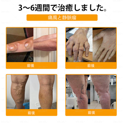 🇯🇵 日本製・日本から直送 🌱XRLXRL®🐝 ミツバチ毒配合🦴 関節・膝・腰・肩を毎日ケア✨ 軽やかな動きをサポート💚