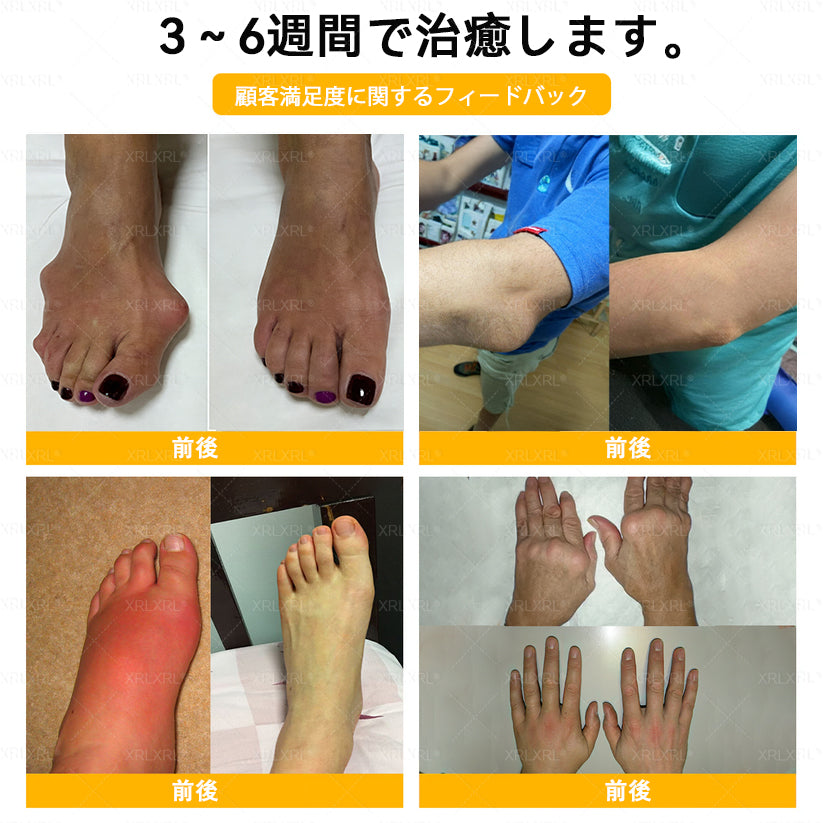 🇯🇵 日本製・日本から直送 🌱XRLXRL®🐝 ミツバチ毒配合🦴 関節・膝・腰・肩を毎日ケア✨ 軽やかな動きをサポート💚