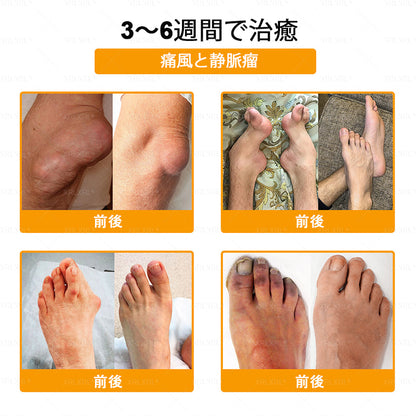 🇯🇵 日本製・日本から直送 🌱XRLXRL®🐝 ミツバチ毒配合🦴 関節・膝・腰・肩を毎日ケア✨ 軽やかな動きをサポート💚